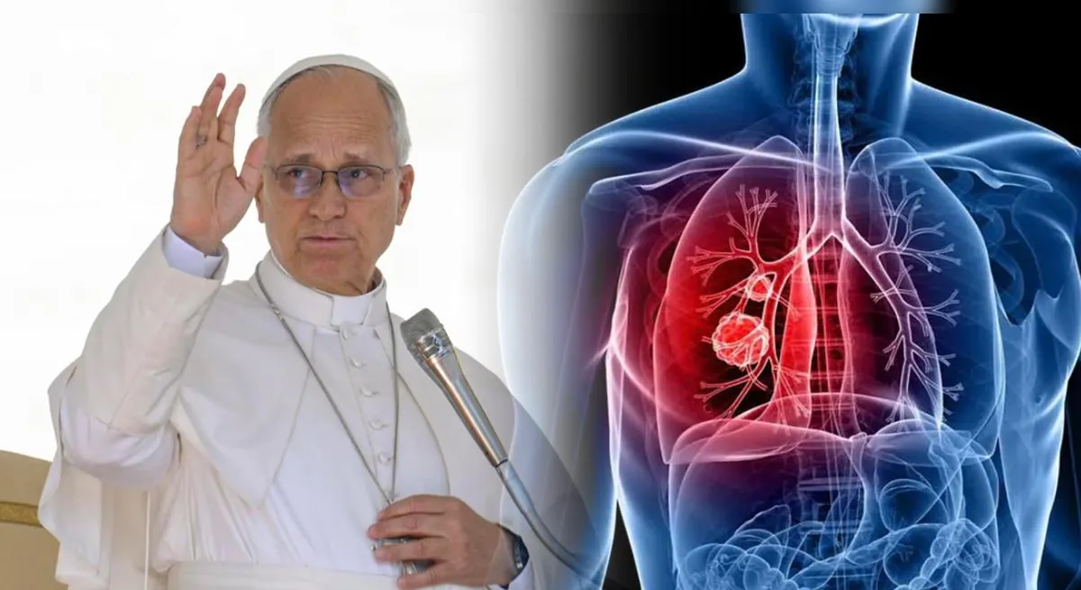 ¿El nódulo pulmonar del papa León XIV podría ser cáncer? Doctor Elmer Huerta qué es y qué riesgo existe en operación