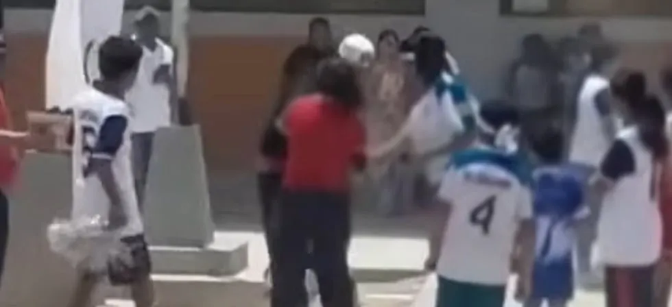 Piura: Escolar de 9 años se quema cara y pecho durante actividad en colegio